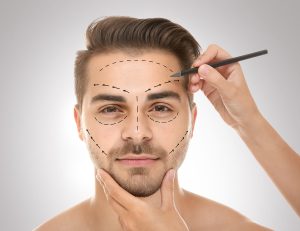 Bărbat cu marcaje pe față pentru o intervenție estetică